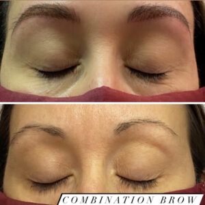 Combination Brow (1)