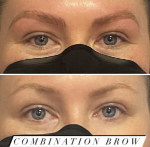 Combination Brow (9)